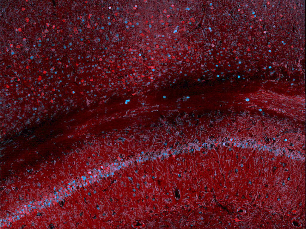 Scientists use blood test to track gene expression in the brain
